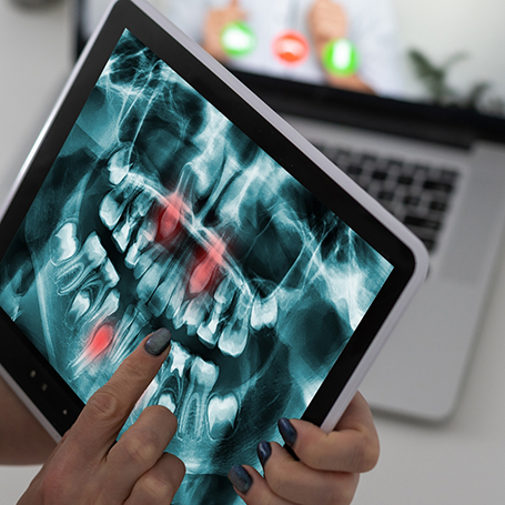 Dentist looking at x-rays of teeth on a tablet