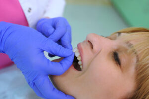 Dentist placing veneers on patient’s front teeth