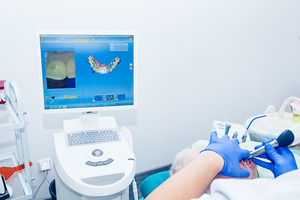 Creating digital impression with CAD/CAM technology
